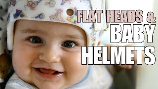 Pediatrician Explains Plagiocephaly Flattening of Head and Helmeting Baby Helmets [upl. by Fogel]