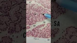 Lacrimal Gland Histology Quick Overview [upl. by Ardnal970]