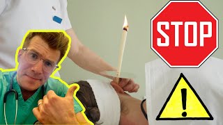 Is ear candling safe to remove ear wax Doctor explains shorts [upl. by Carmel984]