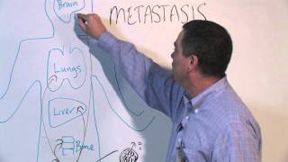 How Cancer Spreads Metastasis  Michael Henry PhD [upl. by Idnahs]