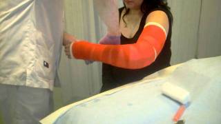 Broken arm putting on new gypsum [upl. by Ytineres]