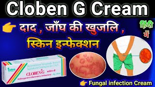 Cloben G Cream Uses in Hindi  Cloben cream use for Fungal infection  Skin disease Cream [upl. by Kono81]