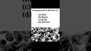 quotOsteoporosisquot Mdcat preparing for mcqs of biology biology mdcat [upl. by Dressel713]