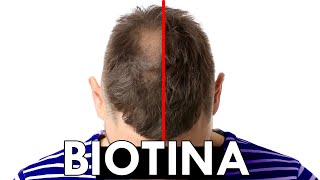 BIOTINA para el PELO explicado por MÉDICO ¿FUNCIONA [upl. by Attolrahc424]