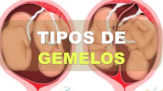 ¿Qué tipos de Gemelos hay Explicación fisiológica [upl. by Nnaecyoj]