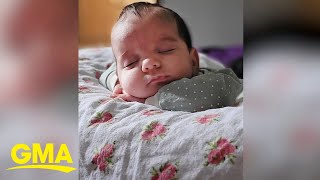 Baby girl born with rare 4pound tumor [upl. by Nautna799]