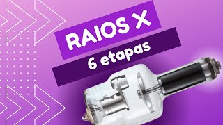 A PRODUÇÃO DE RAIOS X EM 6 ETAPAS POR ACADEMIA DE RADIOLOGIA [upl. by Ivgnout]