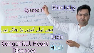 Blue baby  Cyanosed Baby  Cyanosis  Class 11  Biology  Dr Mushtaq Lectures [upl. by Lani639]