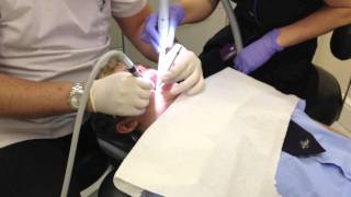 dentist injection drill and filling [upl. by Goddord]