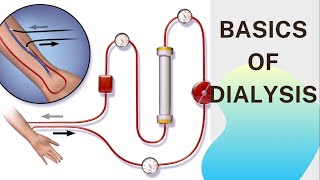 Basic concept of Dialysis Machine  Fresenius 4008S  Dialyzer amp Dialysate Function [upl. by Laius672]