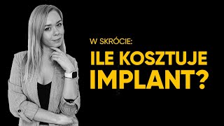 ILE KOSZTUJĄ IMPLANTY ZĘBÓW [upl. by Ivets72]