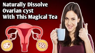 How To Cure Ovarian Cyst l Effective Remedy For Ovarian Cyst l How To Disolve Ovarian Cyst Naturally [upl. by Eneirda]