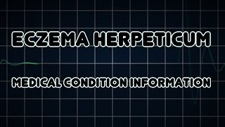 Eczema herpeticum Medical Condition [upl. by Atineb666]