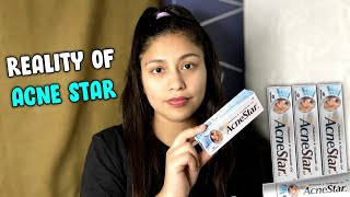 Acnestar Gel review  How to Get rid of Acne  Noni Roga [upl. by Aniehs]