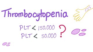 Thrombocytopenia  Why Is My Platelet Count Low [upl. by Anaizit]