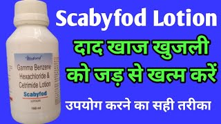 Scabyfod Lotion  Uses Side Effects  शरीर में होने वाली खुजली से पाएं छुटकारा [upl. by Eelannej]