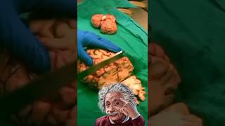 Why Albert Einstein Brain cut into 240 pieces [upl. by Irrot]