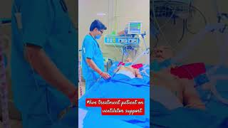 live treat patients on ventilator support ajeetsingh medical ki duniya short [upl. by Ylrebmit]