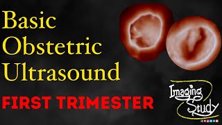 Basic Obstetric Ultrasound First Trimester Pregnancy [upl. by Alidus5]