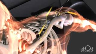 Heal  The medical animation of extreme trauma and repair  5th Anniversary [upl. by Zerla]