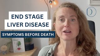 End Stage Liver Disease Symptoms Before Death liverdisease [upl. by Lirbij215]