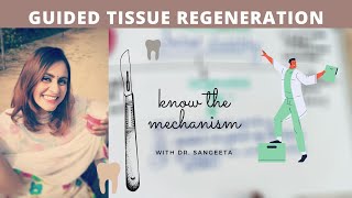 guided tissue regeneration lecture [upl. by Netsyrk211]