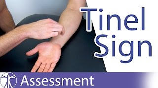 Tinel Sign Wrist  Carpal Tunnel Syndrome Diagnosis [upl. by Angele]