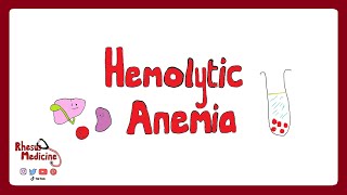 HEMOLYTIC ANEMIA Extravascular v Intravascular Clinical Features Diagnosis Coombs Test  Rhesus [upl. by Kcirdaed]