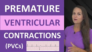 Premature Ventricular Contractions PVCs ECG Nursing NCLEX Bigeminy Trigeminy [upl. by Camellia172]