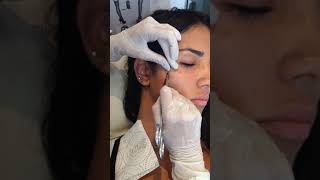 Colocando um piercing Microdermal no rosto [upl. by Ayvid]