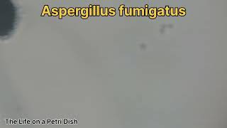 Aspergillus niger fumigatus and flavus [upl. by Ylil]