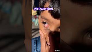 Afif Chokhe 🦟 Insects 🦟 viralvideoshortsfeedshortvideosziniaopublogs [upl. by Strade]