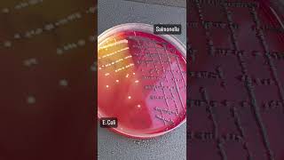 salmonella vs e coli culture [upl. by Analrahc]