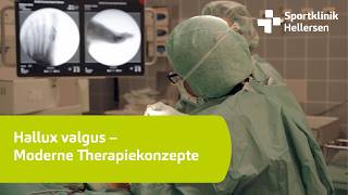 Hallux valgus – Moderne Therapiekonzepte [upl. by Eciened906]