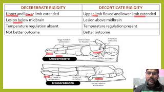 Differences between Decorticate Posturing and Decerebrate Posturing [upl. by Batory360]