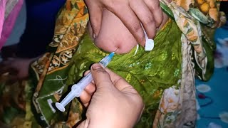 IM Intramuscular Arm injection Push Dexamethasone injection Video 24 Ep 29 Anik Health Tips [upl. by Elbertina]