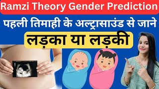 Ramzi method or Theory for Gender Prediction  Baby Boy Symptoms During pregnancy Ultrasound Report [upl. by Ardnuhs]