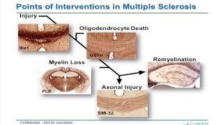 Renovo Neural amp CHI  Neurohistology Webinar  1192016 [upl. by Chrissa]