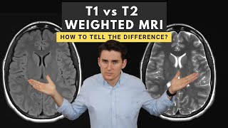 T1 vs T2 weighted MRI images How to tell the difference [upl. by Modestia801]