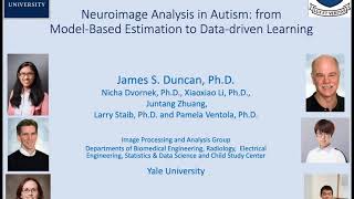 Neuroimage Analysis in Autism from ModelBased Estimation to Datadriven Learning [upl. by Earehc219]