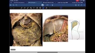 Anatomy L6 C1 The Peritoneum P1صوت الدكتور واطي نتفه اليوم، عشان ما كان في مايك بالقاعه [upl. by Reppart]