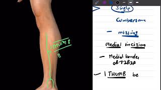 Compartment syndrome DNB MSORTHOPAEDIC NEETPG [upl. by Aker]