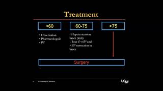 Scheuermann’s Kyphosis  Alekos Theologis MD on August 2 2024 [upl. by Schuster]