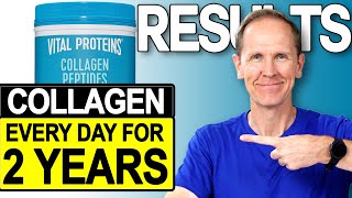 Vital Proteins Collagen Peptides  Results After 2 Years [upl. by Moureaux]