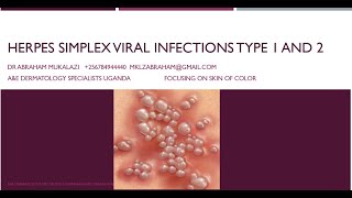 HERPES SIMPLEX VIRUS 1 amp 2 INFECTIONSeducation funny skincondition std skindisease [upl. by Keith329]