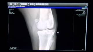 Dog with Torn ACL in Left Knee  High Desert Veterinary [upl. by Itnaihc]