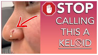 STOP CALLING BUMPS ON YOUR PIERCING KELOIDS [upl. by Sulrac]