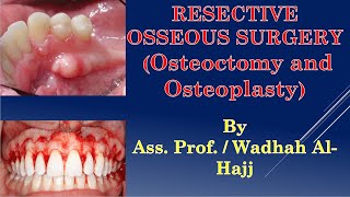 42Periodontal surgery11Resective osseous surgeryDr Wadhah Periodontology lecturesدوضاح الحاج [upl. by Nylannej324]