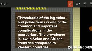 Puerperal venous thrombosis [upl. by Niraj]