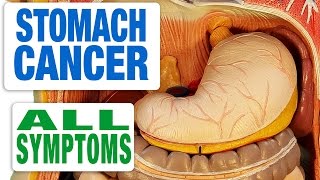 Stomach Cancer  All Symptoms [upl. by Maximo562]